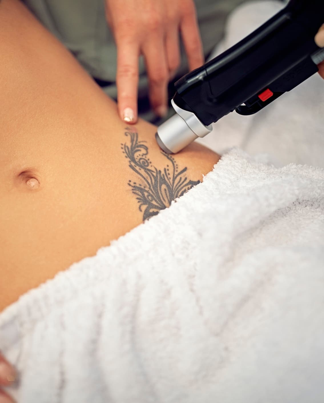 Laser Hair Removal