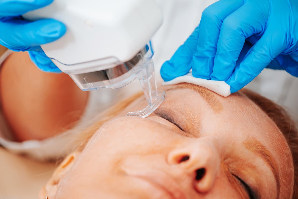Laser Hair Removal