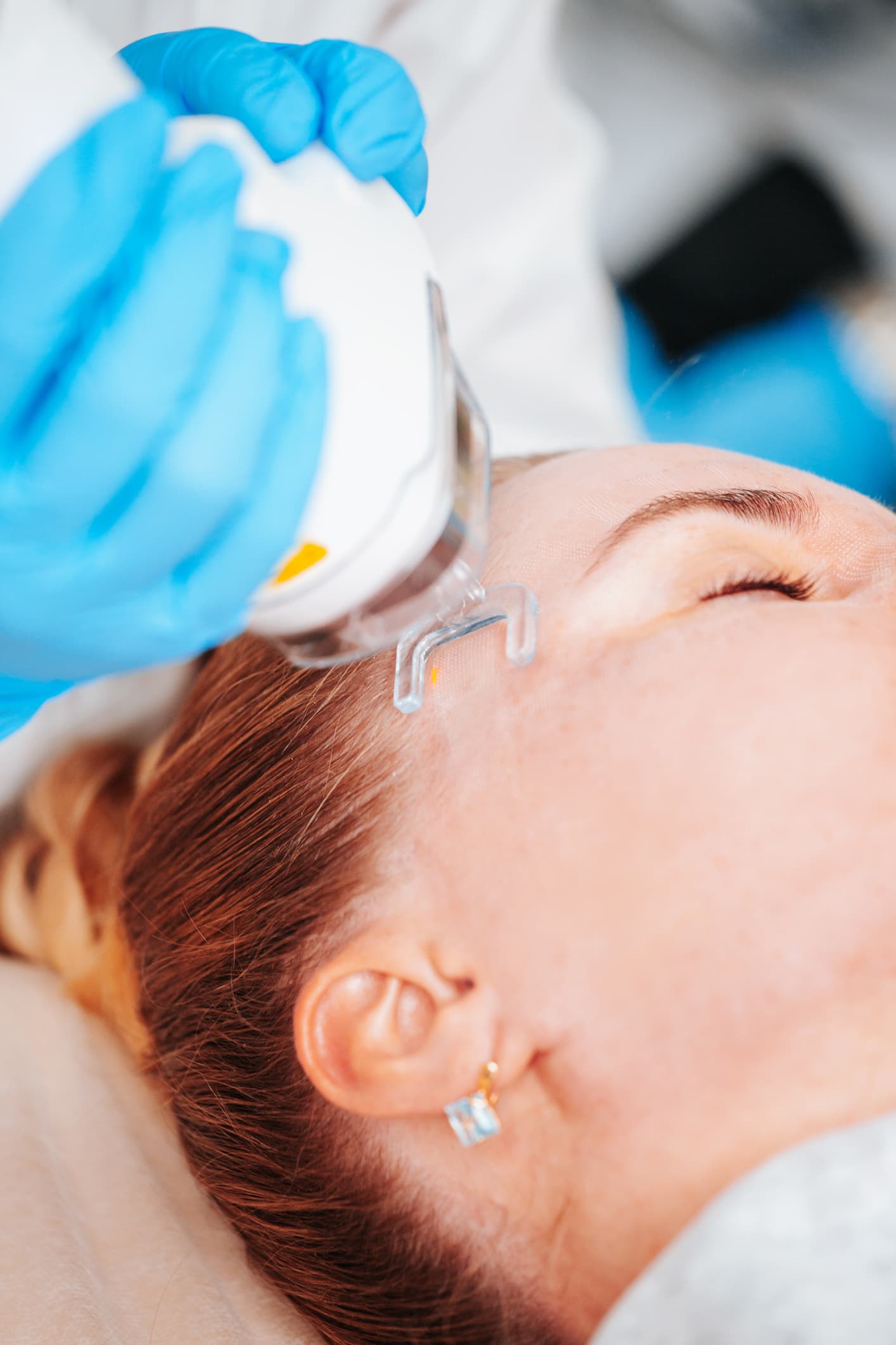 Laser Hair Removal