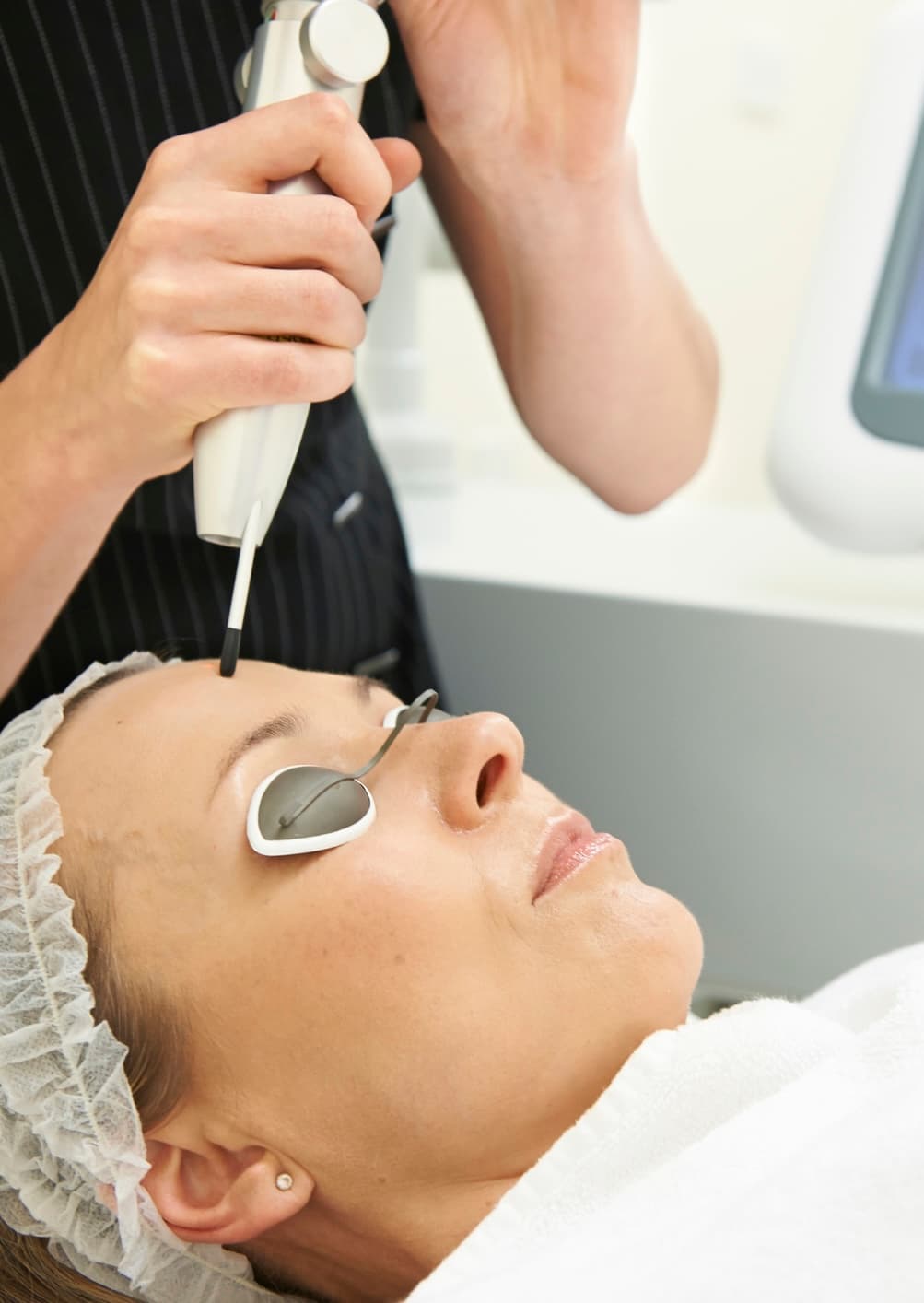 Laser Hair Removal